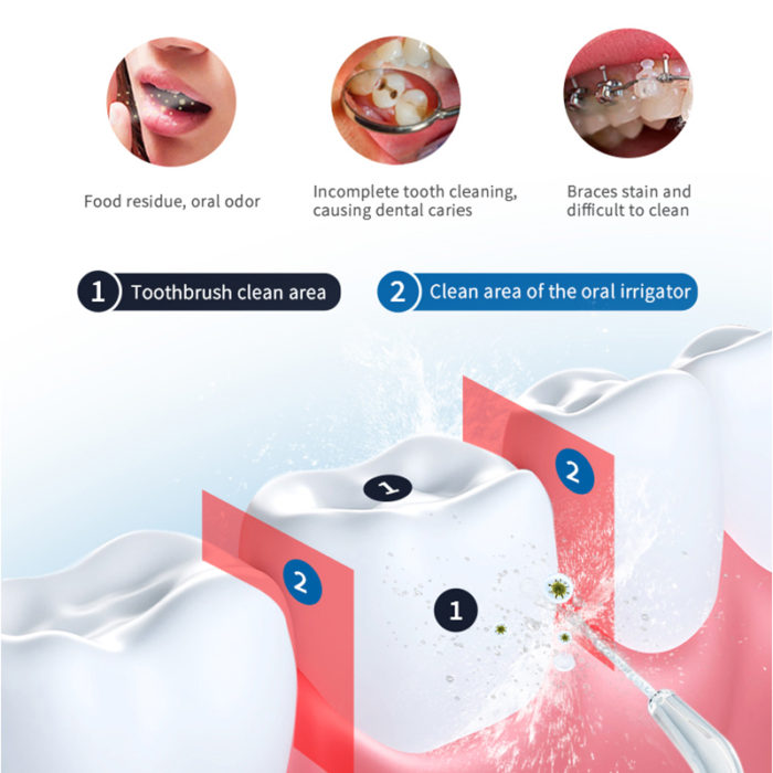 Water Flosser Teeth Cleaning Flosser Cordless Water Teeth Water Flosser - Image 7